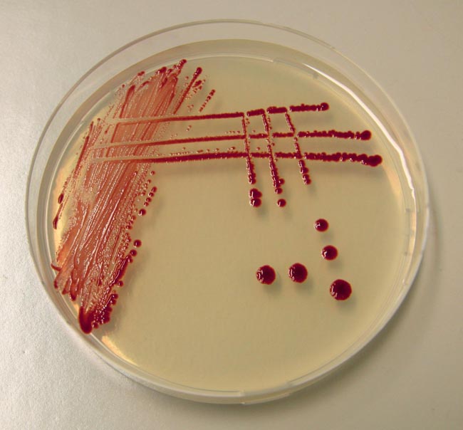 Roseobacter-Bakterien in der Petrischale